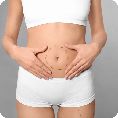 Abdominoplasty (Tummy Tuck)