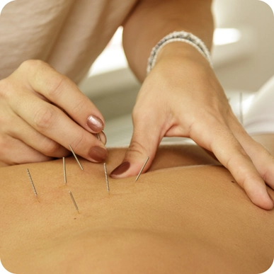 Acupuncture / Acupressure