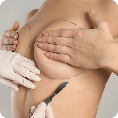 Breast Reduction