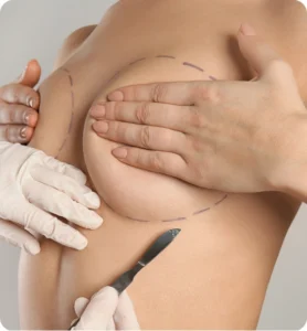 Breast Surgery Abroad Enhancing Confidence with Precision & Care