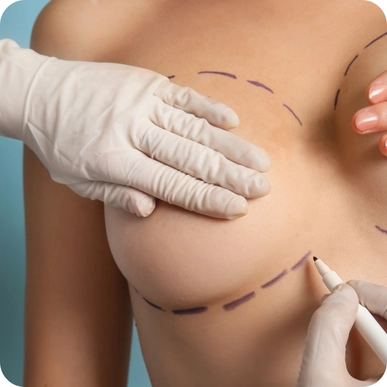 Breast Surgery