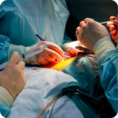 Cardiothoracic Surgery