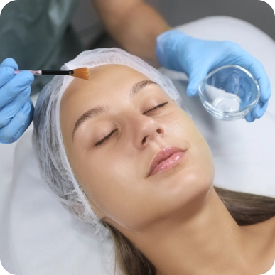 Chemical Peels