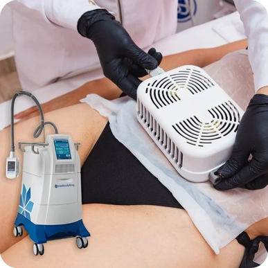 CoolSculpting (Cryolipolysis)