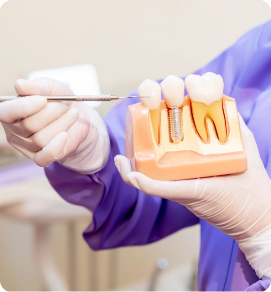 Dentures and Implants Abroad Rebuild Your Smile with Confidence