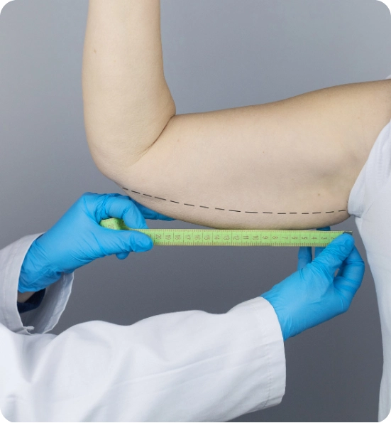 Discover the Best Countries for Arm Lift Surgery Abroad Transform Your Upper Arms with Brachioplasty