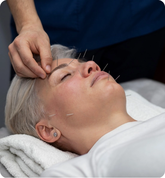 Experience Natural Healing with Acupuncture Therapy and Acupressure Treatment