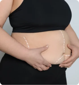 Explore the Best Countries for Liposuction Abroad Safe & Effective Fat Removal Solutions