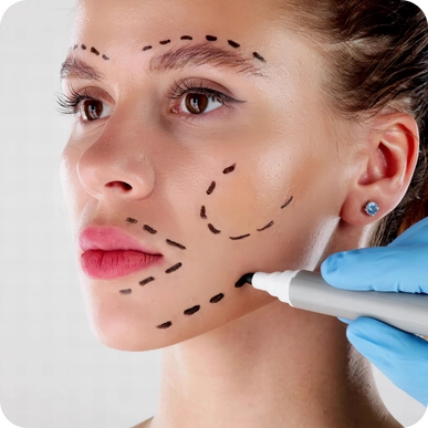 Facelift (Rhytidectomy)