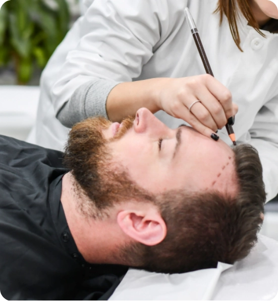 Follicular Unit Transplantation Achieve Fullness with Proven Hair Restoration