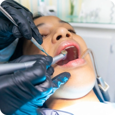 Full Mouth Reconstruction