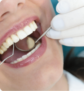 Gum Disease Treatment Abroad Rebuild Your Smile with Confidence