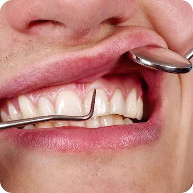 Gum Treatments