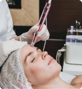 Microneedling Abroad Achieve Smoother Skin Through Natural Regeneration