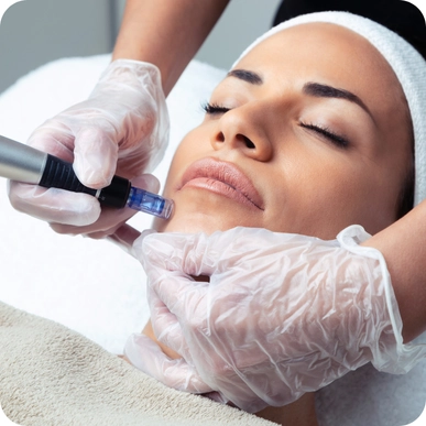 Microneedling