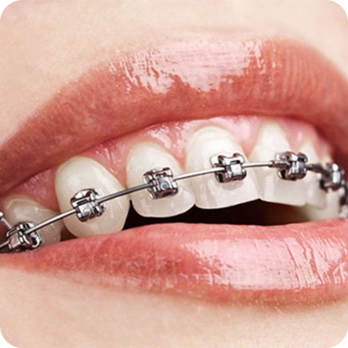 Orthodontics