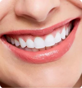 Smile Makeover Abroad Redesign Your Smile with Confidence
