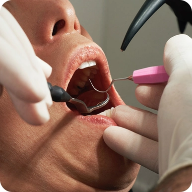 Tooth Contouring