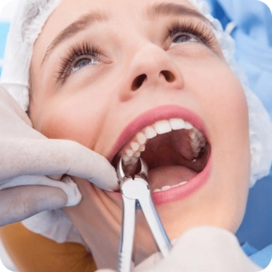 Tooth Extractions (Including Wisdom Teeth)