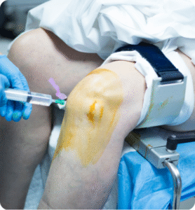 Top Countries for Orthopedic Surgery Affordable and Advanced Care for Musculoskeletal Health